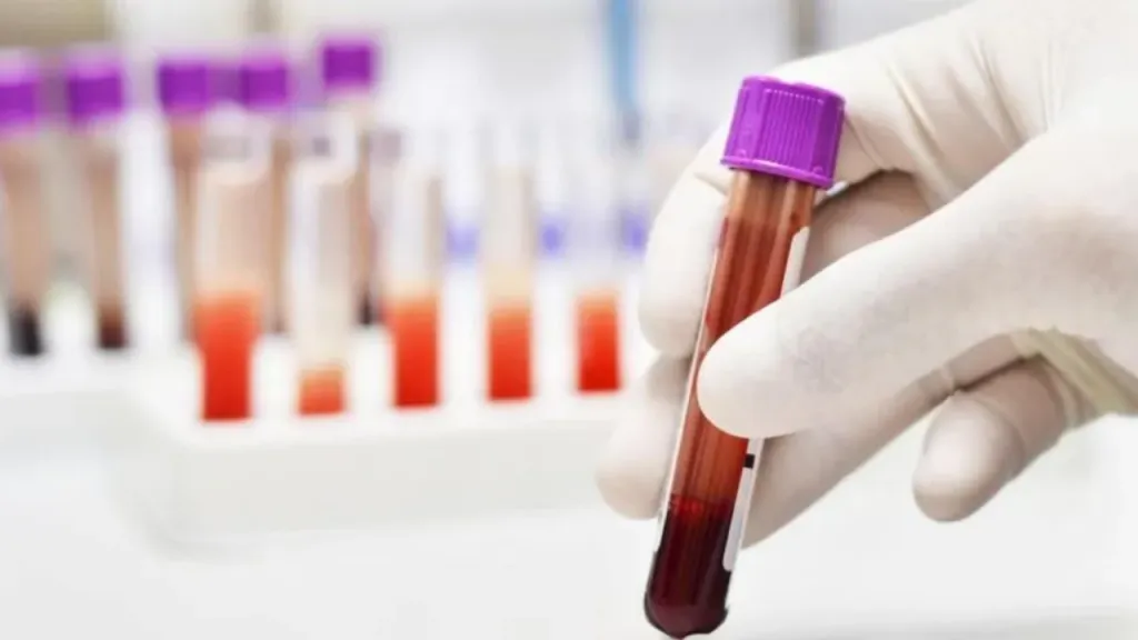 Exames de sangue preveem risco de infarto antes dos primeiros sintomas, aponta estudo